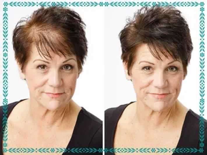 Side-by-side images of a woman showing hair transformation with added volume.
