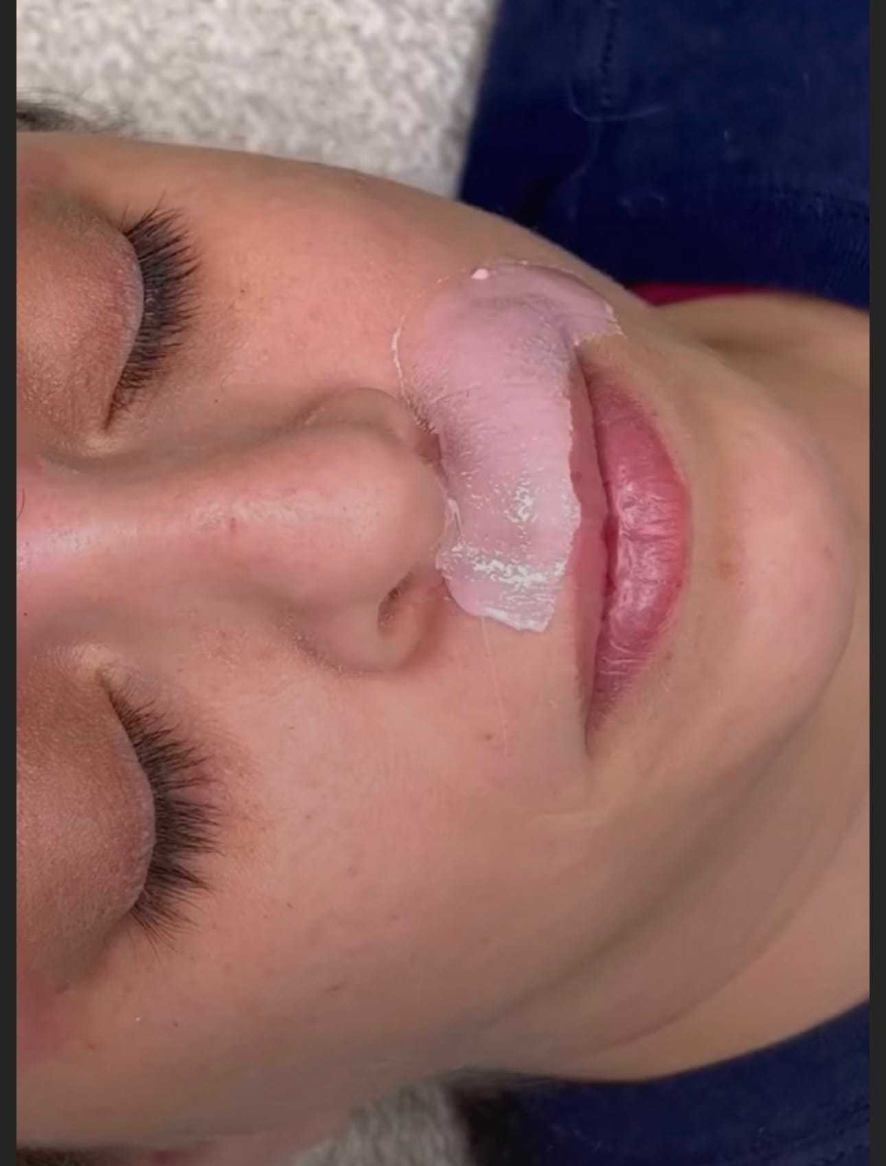 Person receiving an upper lip waxing treatment.
